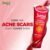 27158f005281eec26e087c48b7290a58.jpg JUNSUI Natural Removes Excessive Oil & Pimple Fighting Face Wash 100g jnpf