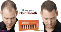 10 Pcs (1 Full Box) Herbal SKIN DOCTOR HAIR GROWTH AMPOULES for Hair Treatment with Anti-Hair Fall. Formulated In FRANCE 10ML Hshg