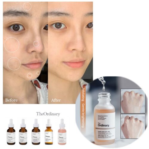 583c1ec836df527cb35818812cab4d22.jpg The ORDINARY Lactic Acid 10% + HA 2% Superficial Peeling Formulation 30ml