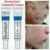 Natural Ingredient BIOAQUA PURE SKIN Anti Acne Scar Mark Remove Oil Control Shrink Pores Remove Pimples Blackhead Anti-Wrinkle Treatment Removal CREAM Spots Scar Blemish Marks fcca