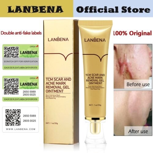 75929767a857ecda53442e69d726a906.jpg Authentication LANBENA TCM Scar Removal Gel / CREAM / Ointment for Surgery, Injury, Burns Keloids, Acne Stretch Marks, Skin Repair, Spots Acne Treatment, Blackhead, Eliminate & Pimple Marks (TCM)