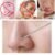 83cff7cad7041236a0406209975c1ae8.jpg Blackhead Pimple Extractor (prt) Remover Stainless Needle