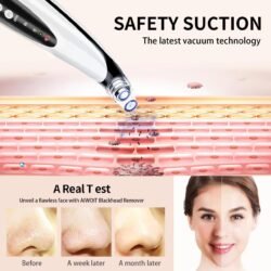 Version 1.0.0 Led Display Blackhead Remover Mrbd Rechargeable 6 Head Machine Multifunctional Pore Vacuum – Electric Acne Tool, Suction Power with Led Display