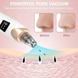 e40432906d5284fc72889f7ebd07fffa.jpg Led Display Blackhead Remover Mrbd Rechargeable 6 Head Machine Multifunctional Pore Vacuum – Electric Acne Tool, Suction Power with Led Display