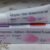 Rx SKINLITE (SKIN LITE ) Hydroquinone + Tretinoin + Mometasone Furoate CREAM 25g (slht)